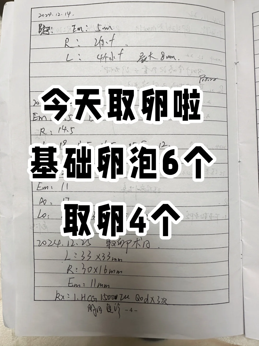 今天取卵啦，基础卵泡6个，只取到了4个