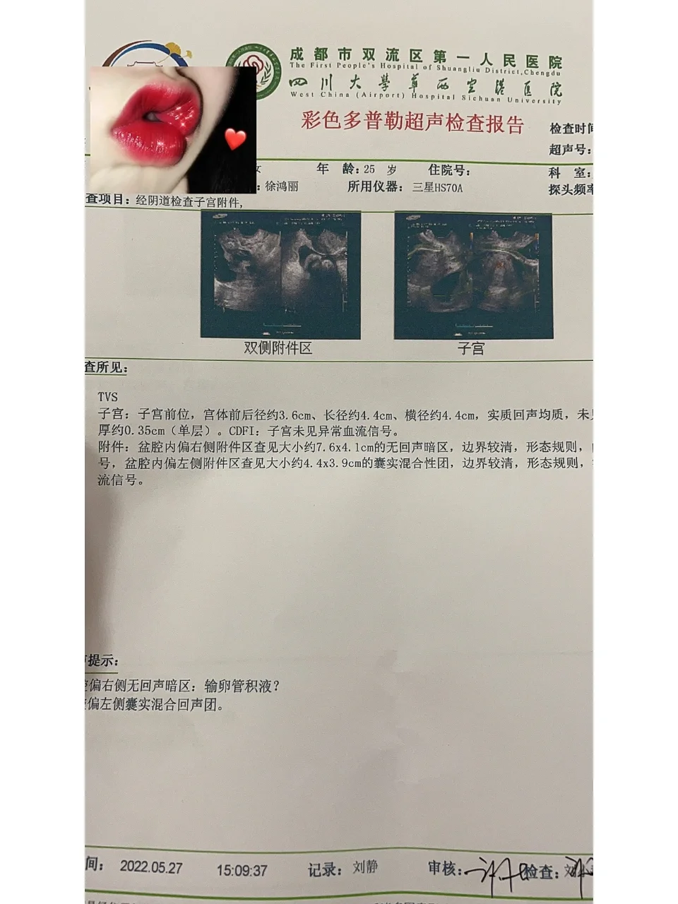 囊肿一定要重视