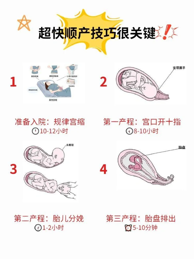 助产士给的超快顺产技巧｜附生宝宝流程,ab血型代孕，正规代生生殖助孕机构