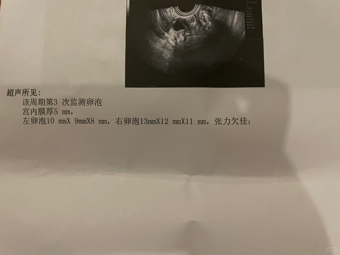 第16天卵泡长不大还张力欠佳